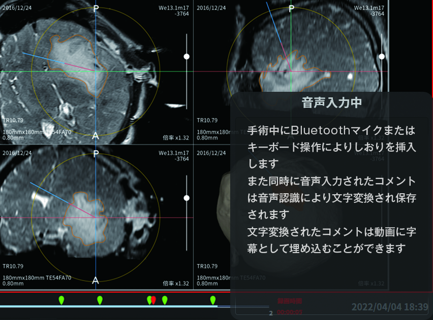 2しおり挿入音声認識機能